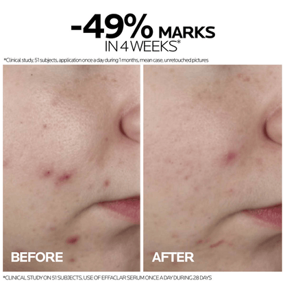 La Roche-Posay Effaclar Ultra Concentrated Serum – 30ml