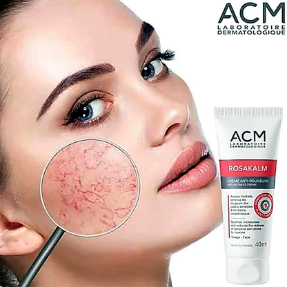 ACM Rosakalm Anti-Redness Cream for Sensitive Skin – 40ml