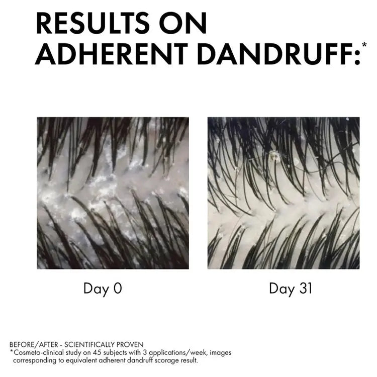 Vichy Dercos Anti-Dandruff DS Shampoo for Dry Hair 200ml