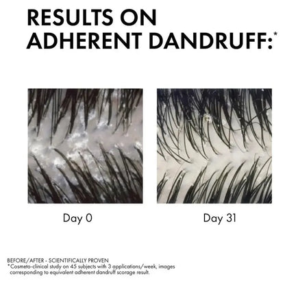 Vichy Dercos Anti-Dandruff DS Shampoo for Dry Hair 200ml